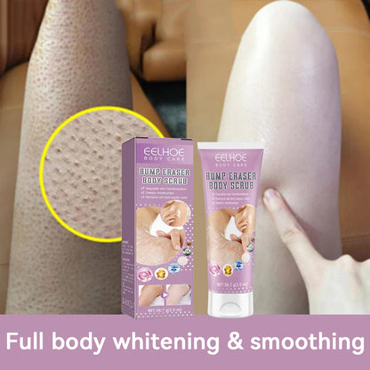 Keratosis Pilaris Cream For Strawberry Legs Removal KP Bump Eraser Dark Spots Face Body Whitening Smooth Moisturizes Skin Care