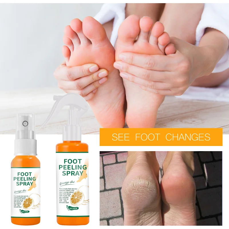 Foot Peeling Spray Natural Orange Essence Pedicure Hands Dead Skin Exfoliator Mask Whiten Baby Foot Care Tool Cosmetics