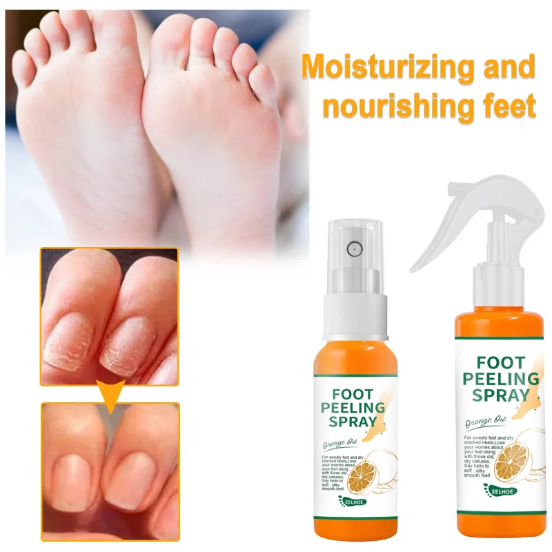 Foot Peeling Spray Natural Orange Essence Pedicure Hands Dead Skin Exfoliator Mask Whiten Baby Foot Care Tool Cosmetics