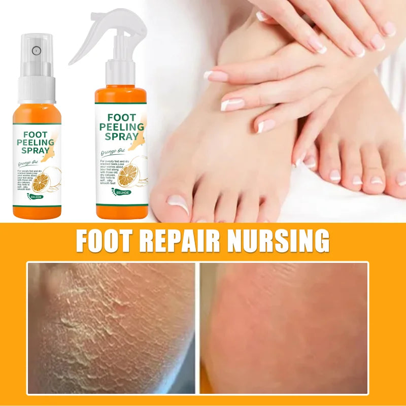 Foot Peeling Spray Natural Orange Essence Pedicure Hands Dead Skin Exfoliator Mask Whiten Baby Foot Care Tool Cosmetics