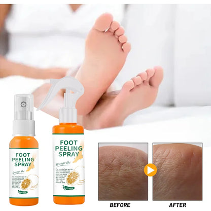 Foot Peeling Spray Natural Orange Essence Pedicure Hands Dead Skin Exfoliator Mask Whiten Baby Foot Care Tool Cosmetics